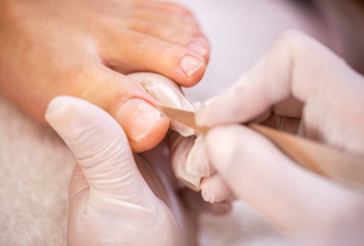 Pedicure